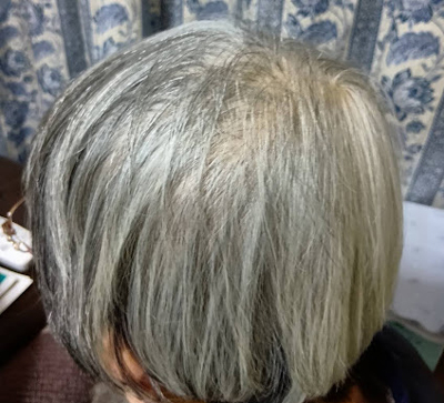 松葉茶を飲み続けている85歳の母の白髪の様子