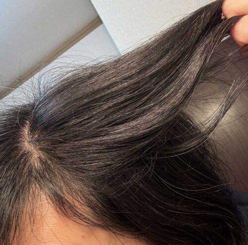 松葉茶 白髪 増加ペース 変化 髪 角度比較で増え方を写真公開