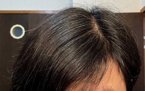 松葉茶を継続して3ヶ月後の白髪の増え方を比較する57才 女性 髪の変化 無修正