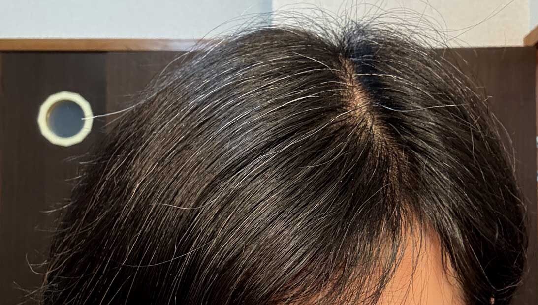 松葉茶を継続して3ヶ月後の白髪の増え方を比較する57才 女性 髪の変化 無修正